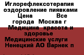 Иглорефлексотерапия, оздоровление пиявками › Цена ­ 3 000 - Все города, Москва г. Медицина, красота и здоровье » Медицинские услуги   . Ненецкий АО,Варнек п.